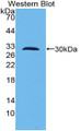 Western Blot; Sample: Recombinant protein.