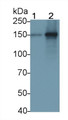 Western Blot; Sample: Recombinant TLR8, Human.