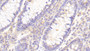 DAB staining on IHC-P; Samples: Human Colon Tissue; Primary Ab: 20μg/ml Rabbit Anti-Human TLR8 Antibody Second Ab: 2µg/mL HRP-Linked Caprine Anti-Rabbit IgG Polyclonal Antibody
