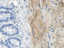DAB staining on IHC-P; Samples: Rat Small intestine Tissue; Primary Ab: 20µg/ml Rabbit Anti-Rat TLR5 Antibody Second Ab: 2µg/mL HRP-Linked Caprine Anti-Rabbit IgG Polyclonal Antibody