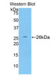 Western Blot; Sample: Recombinant protein.