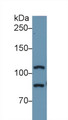 Western Blot; Sample: Human A549 cell lysate; Primary Ab: 1µg/ml Rabbit Anti-Human TLR5 Antibody Second Ab: 0.2µg/mL HRP-Linked Caprine Anti-Rabbit IgG Polyclonal Antibody