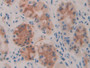 DAB staining on IHC-P; Samples: Human Stomach Tissue; Primary Ab: 30µg/ml Rabbit Anti-Mouse TLR3 Antibody Second Ab: 2µg/mL HRP-Linked Caprine Anti-Rabbit IgG Polyclonal Antibody