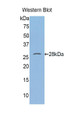 Western Blot; Sample: Recombinant protein.