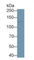 Western Blot; Sample: Human Lung lysate; Primary Ab: 1µg/ml Rabbit Anti-Human PKN2 Antibody Second Ab: 0.2µg/mL HRP-Linked Caprine Anti-Rabbit IgG Polyclonal Antibody