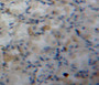 Used in DAB staining on fromalin fixed paraffin-embedded stomach tissue