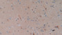 DAB staining on fromalin fixed paraffin- embedded stomach tissue)