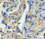 DAB staining on fromalin fixed paraffin-embedded lung tissue)