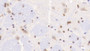 DAB staining on IHC-P; Samples: Rat Cerebrum Tissue;  Primary Ab: 20μg/ml Rabbit Anti-Rat ADAMTS7 Antibody Second Ab: 2µg/mL HRP-Linked Caprine Anti-Rabbit IgG Polyclonal Antibody 