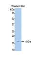 Western Blot; Sample: Recombinant protein.