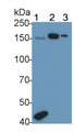 Western Blot; Sample: Recombinant protein.