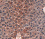 Pigment Epithelium Derived Factor (Pedf) Polyclonal Antibody, Cat#CAU24953