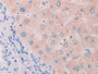 DAB staining on IHC-P; Samples: Human Liver Tissue.