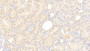 DAB staining on IHC-P; Samples: Human Kidney Tissue;  Primary Ab: 20μg/ml Rabbit Anti-Human C8g Antibody Second Ab: 2µg/mL HRP-Linked Caprine Anti-Rabbit IgG Polyclonal Antibody 