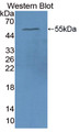 Western Blot; Sample: Recombinant protein.