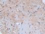 DAB staining on IHC-P; Samples: Rat Heart Tissue; Primary Ab: 30µg/ml Rabbit Anti-Rat SDC1 Antibody Second Ab: 2µg/mL HRP-Linked Caprine Anti-Rabbit IgG Polyclonal Antibody