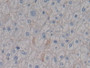 DAB staining on IHC-P; Samples: Human Liver Tissue; Primary Ab: 20µg/ml Rabbit Anti-Human SDC1 Antibody Second Ab: 2µg/mL HRP-Linked Caprine Anti-Rabbit IgG Polyclonal Antibody