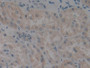 DAB staining on IHC-P; Samples: Human Kidney Tissue; Primary Ab: 10µg/ml Rabbit Anti-Human ALOX12 Antibody Second Ab: 2µg/mL HRP-Linked Caprine Anti-Rabbit IgG Polyclonal Antibody