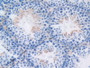 Figure. DAB staining on IHC-P; Samples: Mouse Testis Tissue.