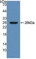 Western Blot; Sample: Recombinant DNM1, Mouse.