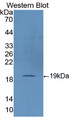 Western Blot; Sample: Recombinant protein.