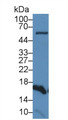 Western Blot; Sample: Human Liver lysate; ; Primary Ab: 6µg/ml Rabbit Anti-Human SOD1 Antibody; Second Ab: 0.2µg/mL HRP-Linked Caprine Anti-Rabbit IgG Polyclonal Antibody;