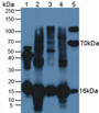 Western Blot; Sample: Lane1: Rat Serum; Lane2: Bovine Liver Tissue; Lane3: Bovine Heart Tissue; Lane4: Bovine Brain Tissue; Lane5: Bovine Serum.