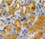 DAB staining on fromalin fixed paraffin-embedded Kidney tissue)