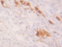 Figure. DAB staining on IHC-P; Samples: Human Ovary Tissue.