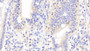 DAB staining on IHC-P; Samples: Human Small intestine Tissue; Primary Ab: 20μg/ml Rabbit Anti-Human IL17F Antibody Second Ab: 2µg/mL HRP-Linked Caprine Anti-Rabbit IgG Polyclonal Antibody
