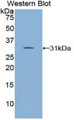 Western Blot; Sample: Recombinant protein.