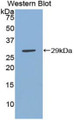 Western Blot; Sample: Recombinant protein.