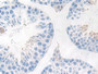 DAB staining on IHC-P; Samples: Mouse Testis Tissue;  Primary Ab: 10µg/ml Rabbit Anti-Mouse IKBIP An