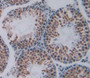 Tar Dna Binding Protein 43Kda (Tdp43) Polyclonal Antibody, Cat#CAU25007