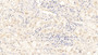 DAB staining on IHC-P. Samples: Human Tissue)