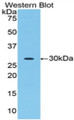 Western Blot; Sample: Recombinant protein.