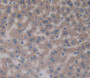 Tissue Factor Pathway Inhibitor 2 (Tfpi2) Polyclonal Antibody, Cat#CAU25026