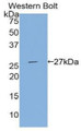 Western Blot; Sample: Recombinant protein.