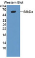 Western Blot; Sample: Recombinant protein.