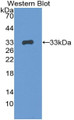 Western Blot; Sample: Recombinant CTSS, Mouse.