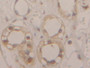 DAB staining on IHC-P; Samples: Human Kidney Tissue; Primary Ab: 20µg/ml Rabbit Anti-Human GAPDH Antibody Second Ab: 2µg/mL HRP-Linked Caprine Anti-Rabbit IgG Polyclonal Antibody