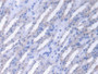 DAB staining on IHC-P; Samples: Mouse Kidney Tissue;  Primary Ab: 20µg/ml Rabbit Anti-Mouse FUM Anti