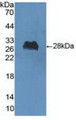 Western Blot; Sample: Recombinant ChAT, Human.