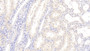 DAB staining on IHC-P; Samples: Human Kidney Tissue;  Primary Ab: 20μg/ml Rabbit Anti-Human MIg Antibody Second Ab: 2µg/mL HRP-Linked Caprine Anti-Rabbit IgG Polyclonal Antibody 