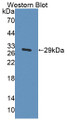 Western Blot; Sample: Recombinant protein.