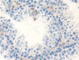 DAB staining on IHC-P; Samples: Mouse Testis Tissue;  Primary Ab: 10µg/ml Rabbit Anti-Mouse Smad4 An