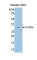 Western Blot; Sample: Recombinant protein.