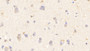 DAB staining on IHC-P; Samples: Human Cerebrum Tissue; Primary Ab: 20μg/ml Rabbit Anti-Human WASP Antibody Second Ab: 2µg/mL HRP-Linked Caprine Anti-Rabbit IgG Polyclonal Antibody