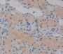 Used in DAB staining on fromalin fixed paraffin- embedded Kidney tissue