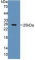 Western Blot; Sample: Recombinant CHRNa4, Human.